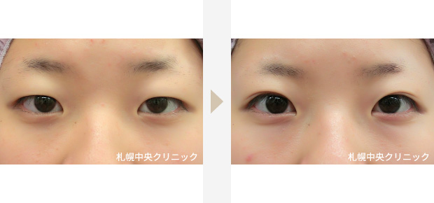 症例フォトギャラリー 札幌中央クリニック 美容外科 美容整形